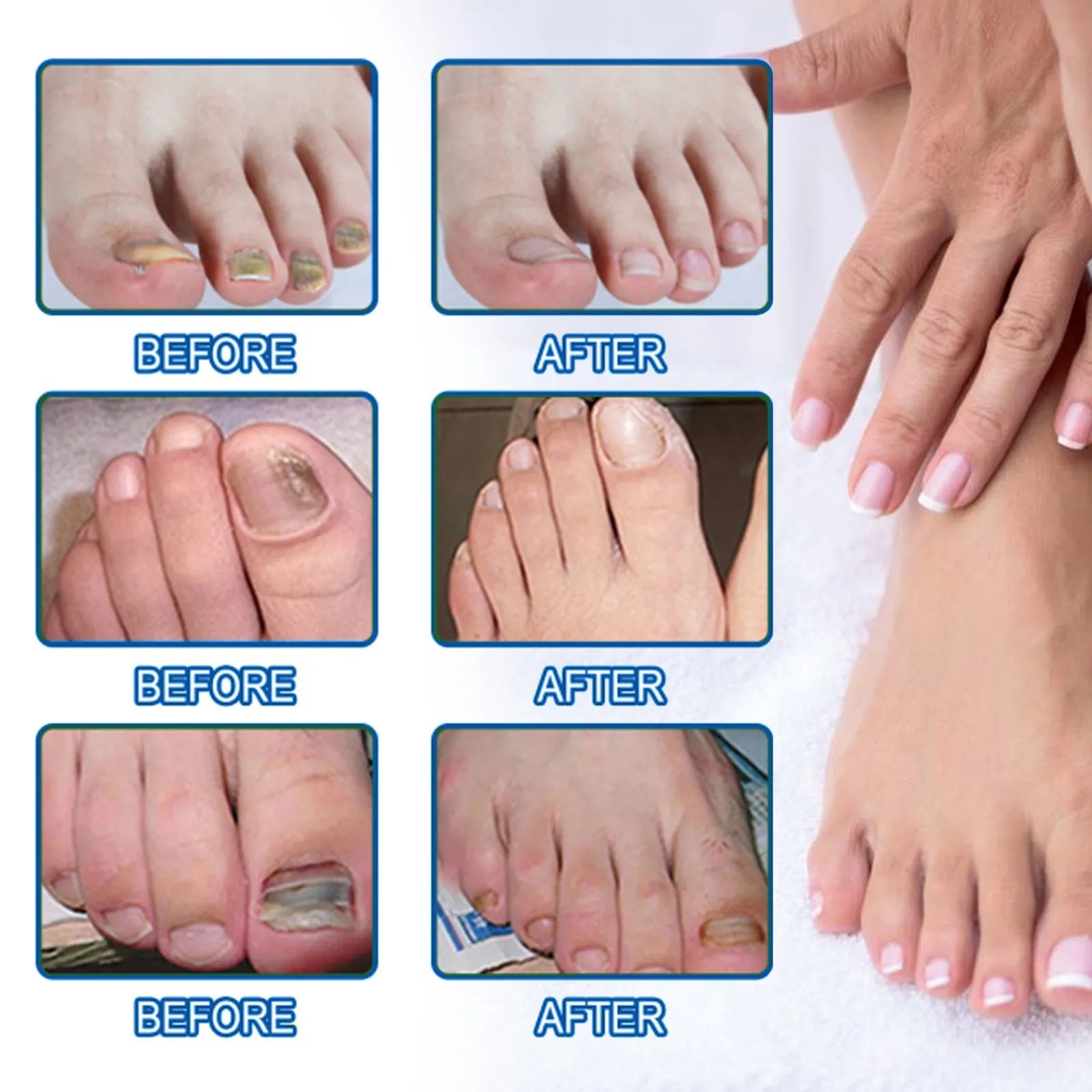 Nail nursing adhesive bandage repair stickers with 32 patches measuring 6.1x3.5 cm