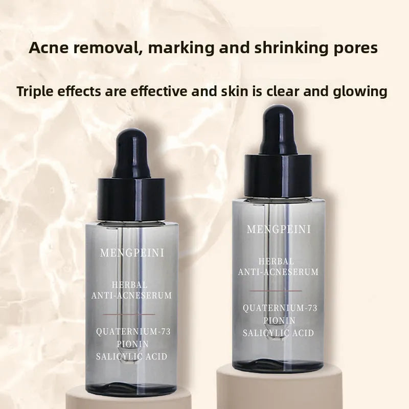 Anti-acne facial essence 30ml box set for closed acne care on neutral skin, English version
