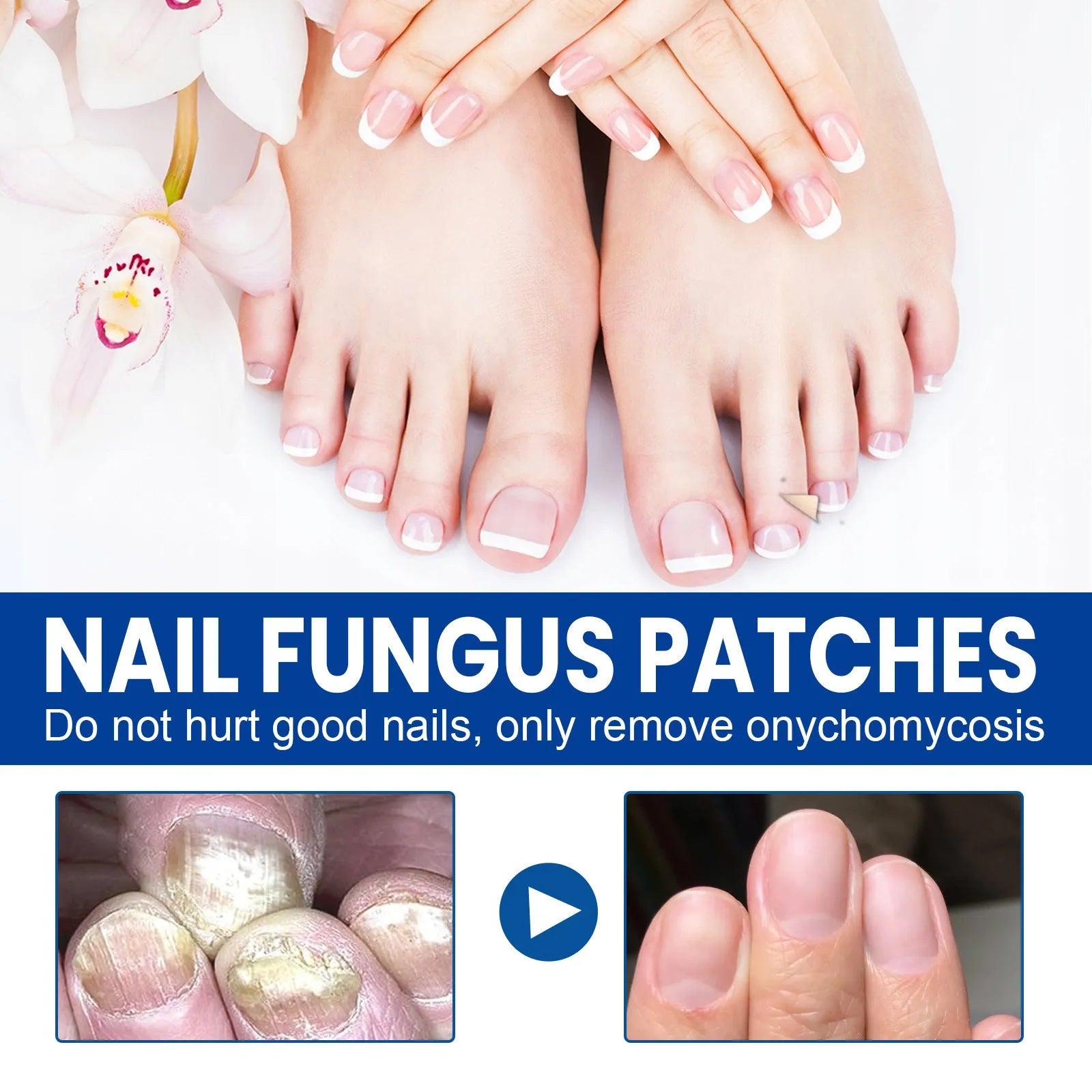 Nail nursing adhesive bandage repair stickers with 32 patches measuring 6.1x3.5 cm