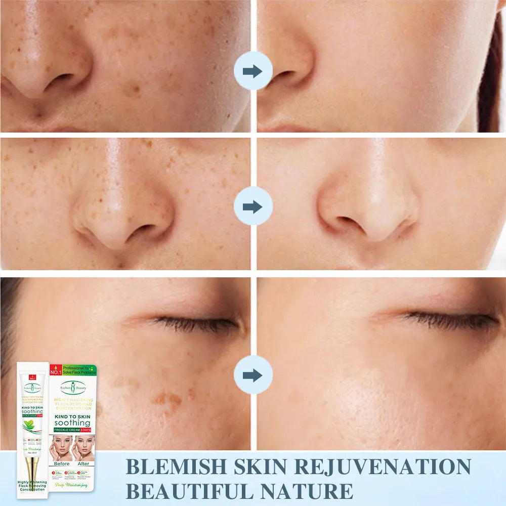 Aichun Anti-Spot Cream 30ml white tube with moisturising concealer for general skin