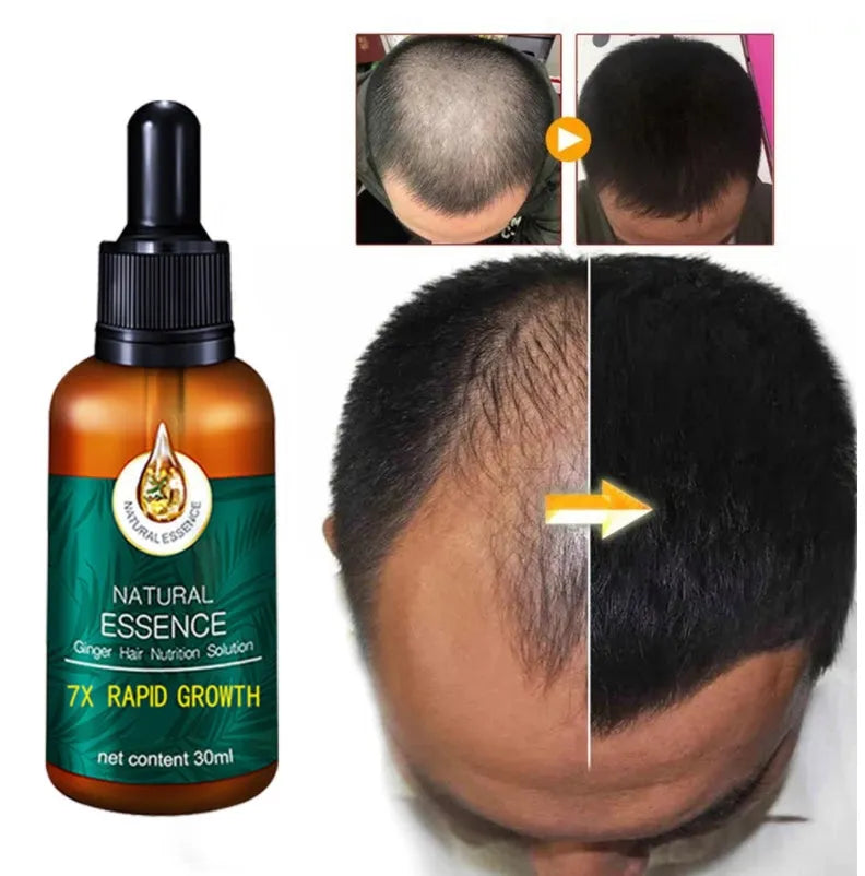 30ml hair growth essential oil bottle for men and women with natural nutrients for follicle repair and thin hair