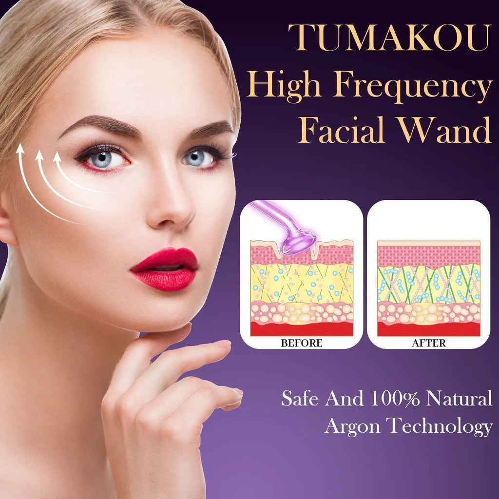 Purple eutic electrotherapy rod with six accessory heads for high-frequency beauty treatments