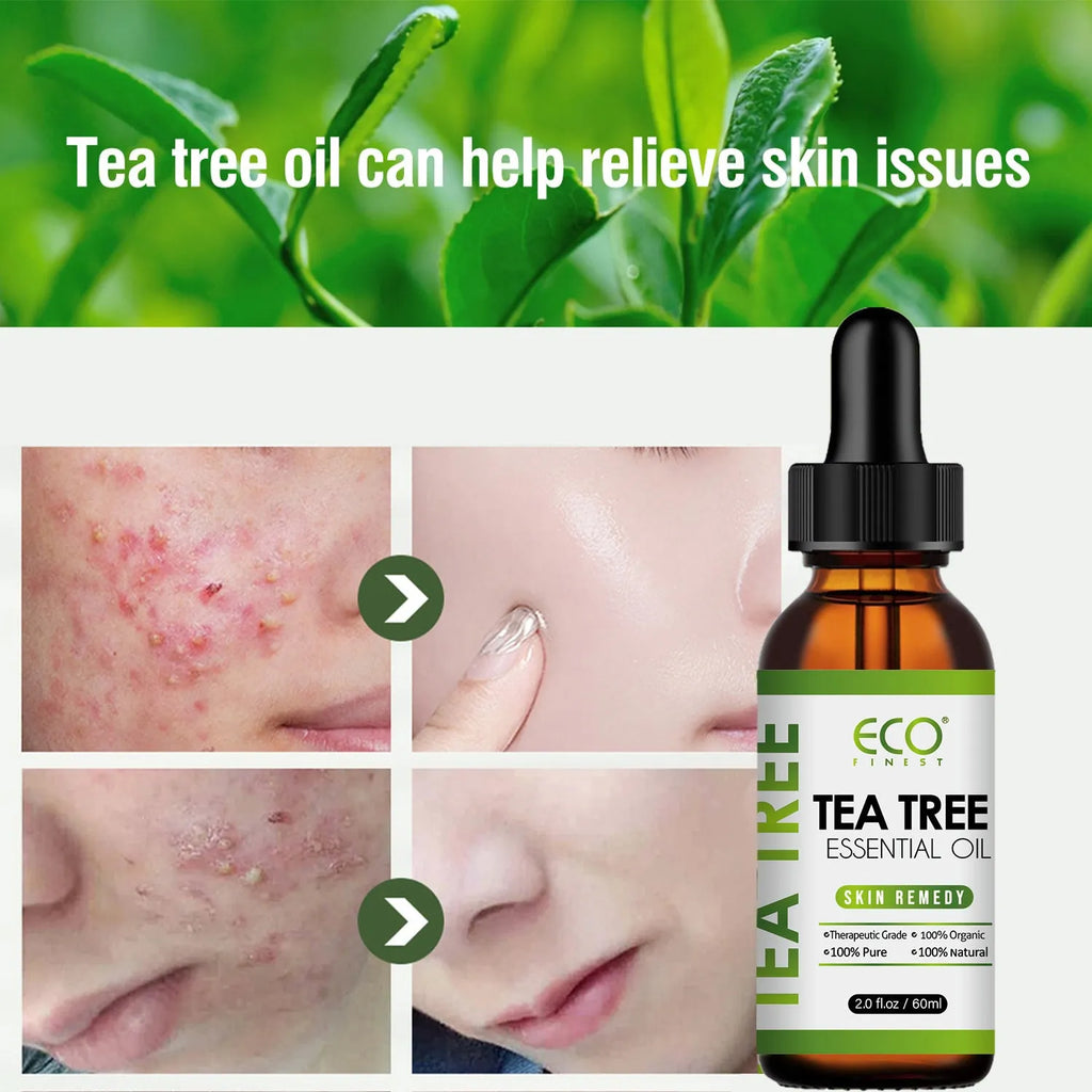 60ml glass bottle of pure tea tree essential oil with a dropper for skincare and aromatherapy