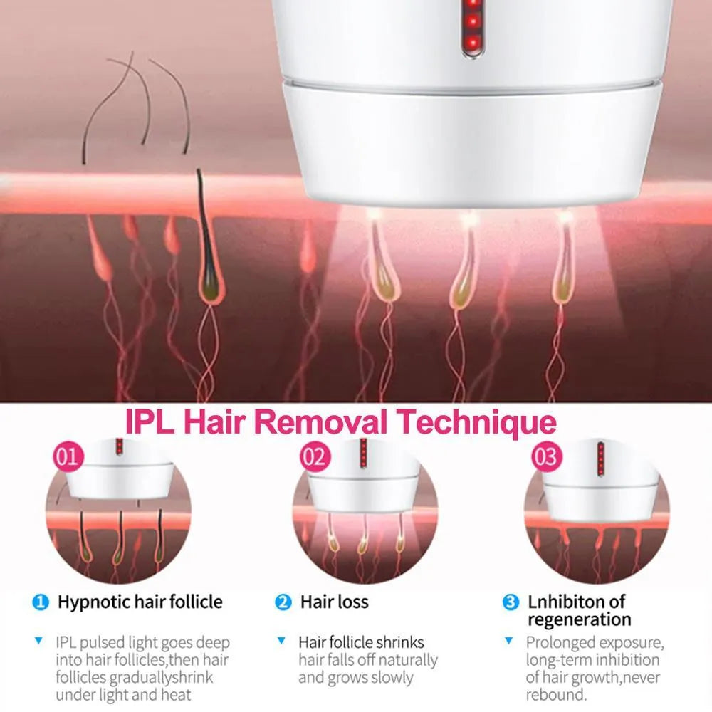 White home laser hair removal device with digital display, shown with international plug adapters.