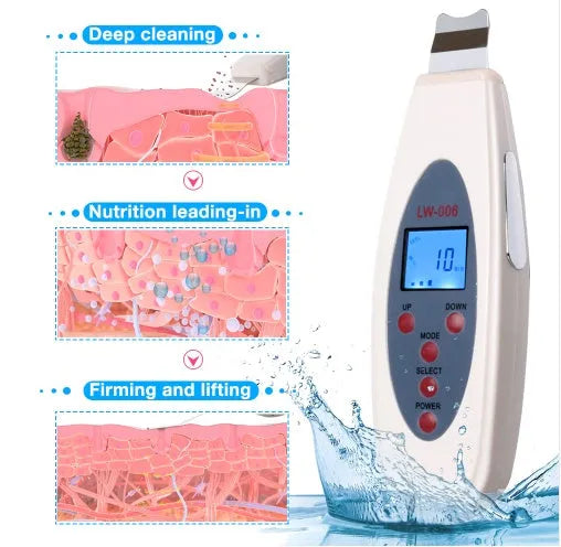 White ultrasonic skin cleaner with blackhead remover function, 28000Hz vibration, mild heating, ABS body, 1.75m cable.