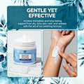 Seborrheic dermatitis cream 100ml tube soothing relief for flaky dry scalp and itchy skin