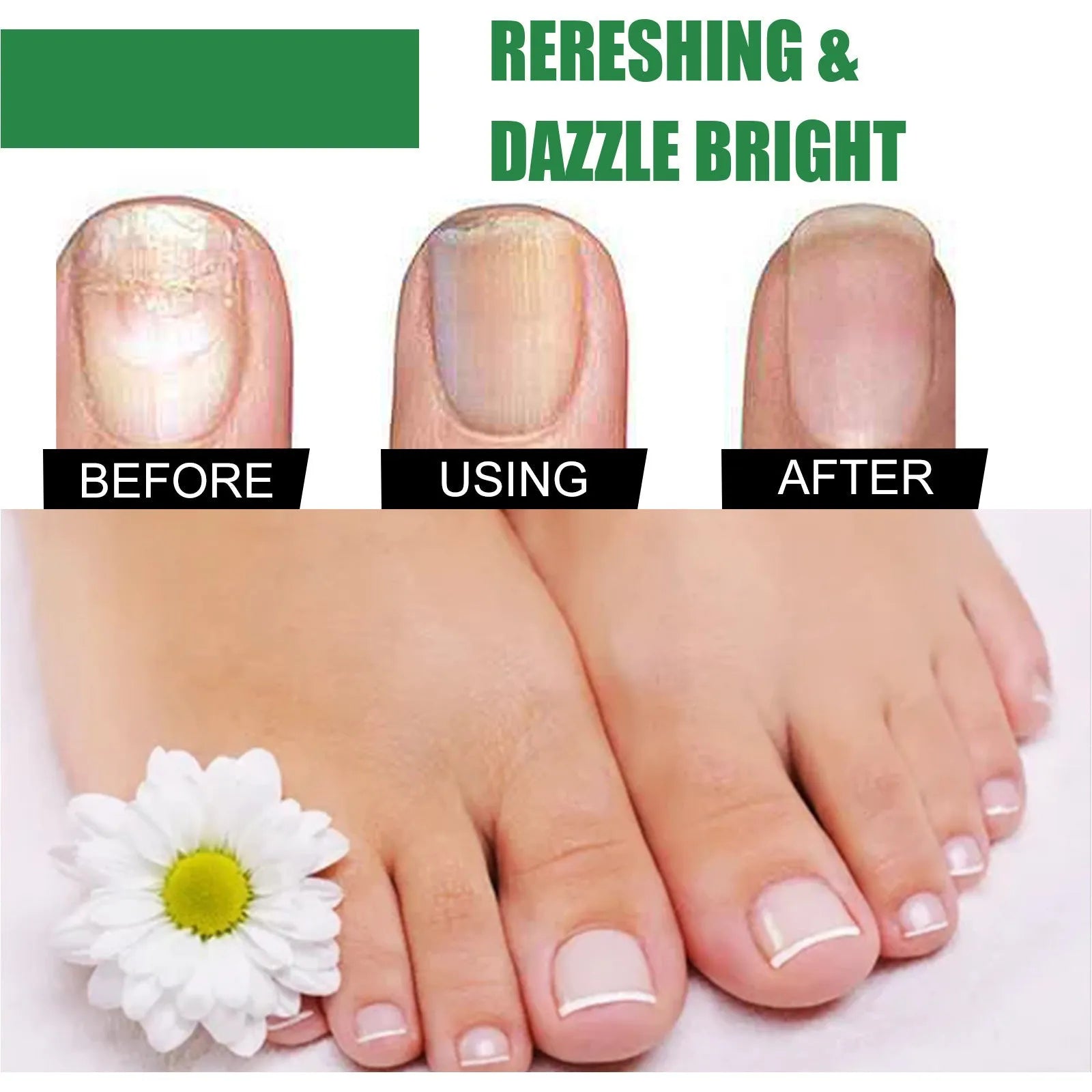 30ml tea tree oil nail care solution bottle for thick soft hand and foot nails