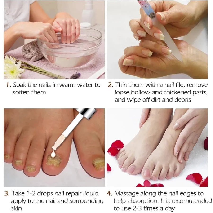 Jiagou whitening nail antibacterial liquid 10ml for foot care