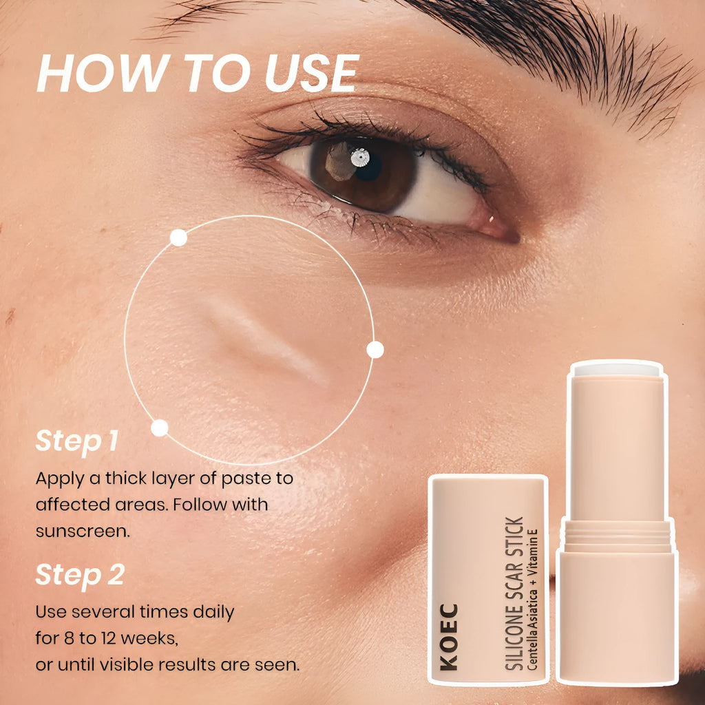 KOEC Silicone Scar Essence Stick 7g in a white twist-up tube on a clean background