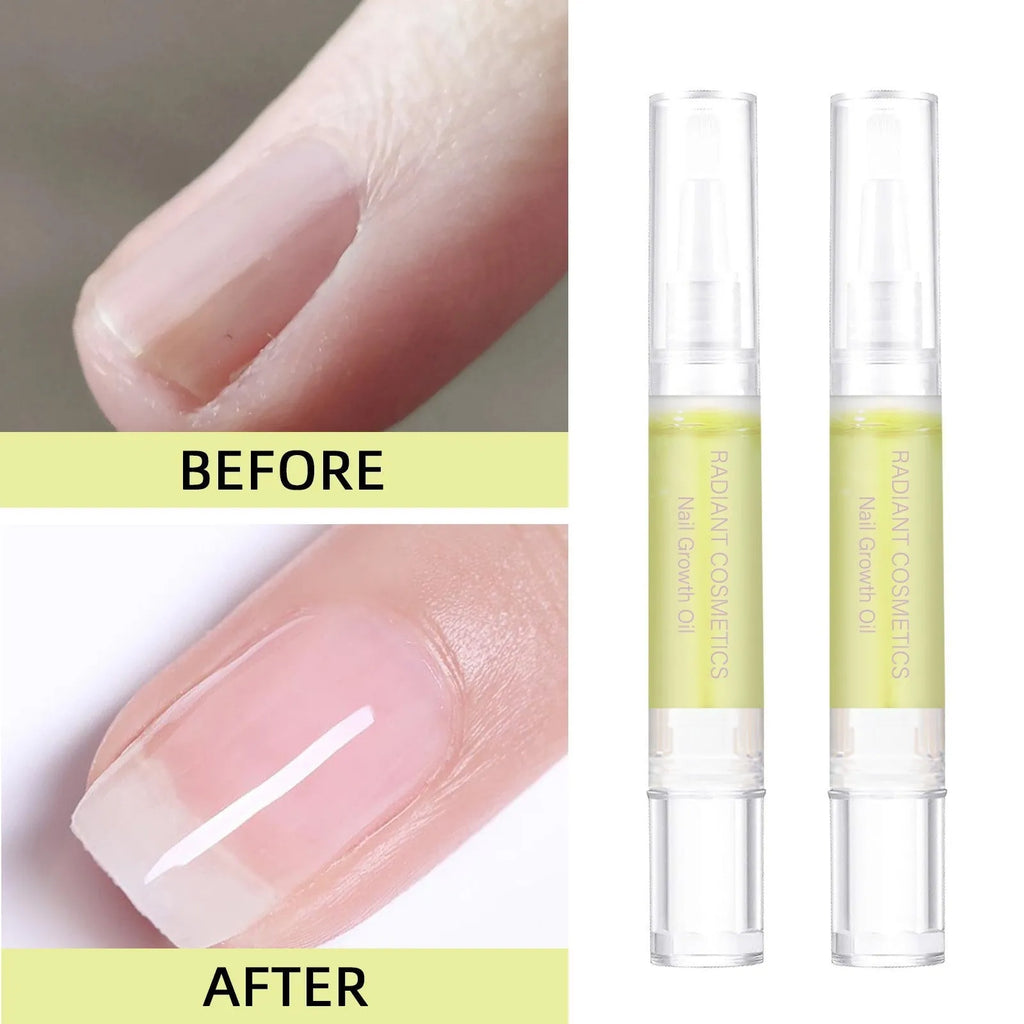 3ml nail growth treatment oil pen for cuticle nourishment and moisturising.