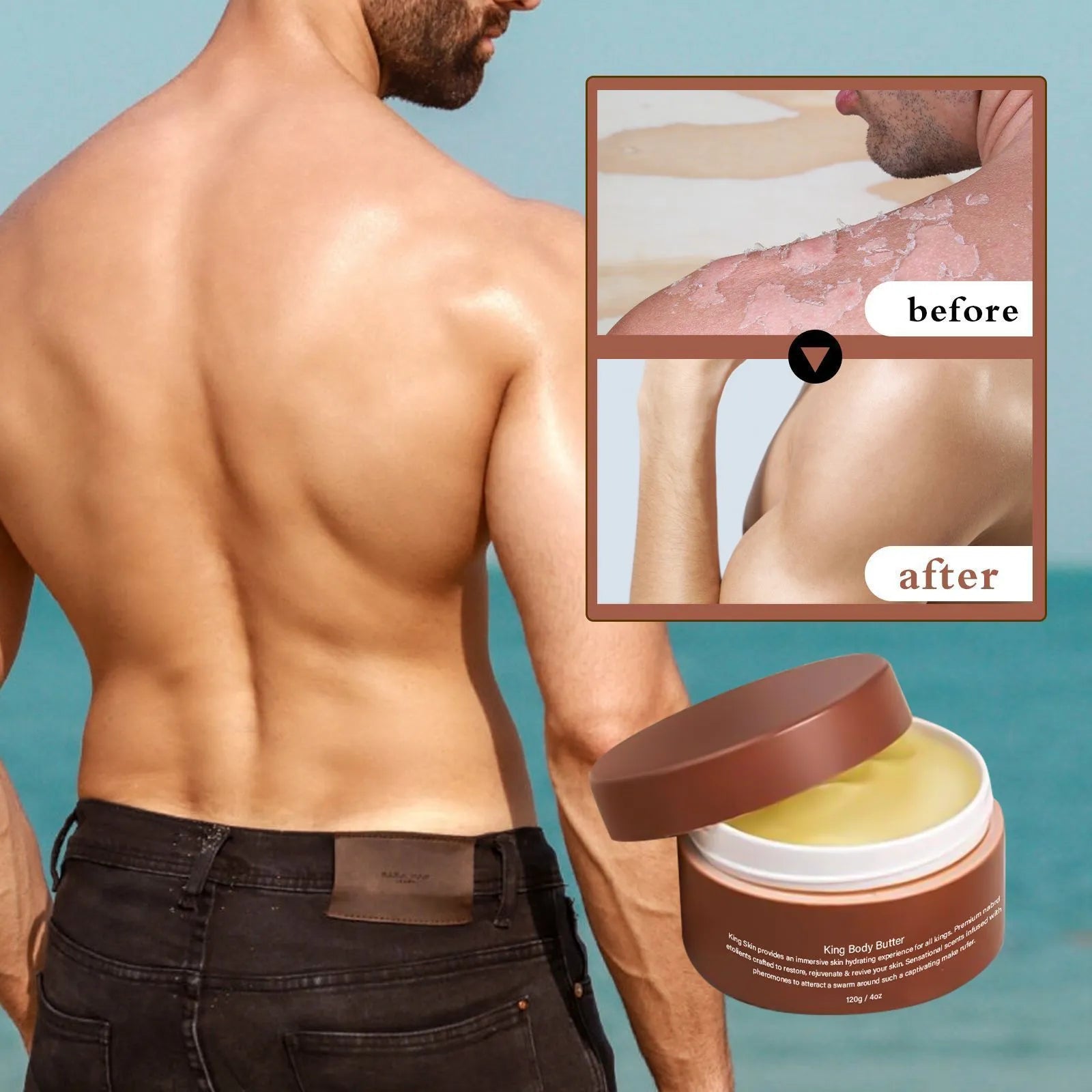 Gulong Body Moisturizer 120g jar for dry skin relief