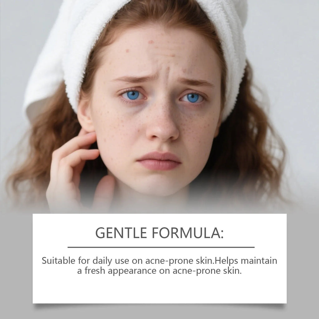 80-count pack of gentle daily cleaning facial acne patches with hydrocolloid material