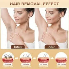 Home-use electric hair removal device with photonic skin rejuvenation and full-body IPL