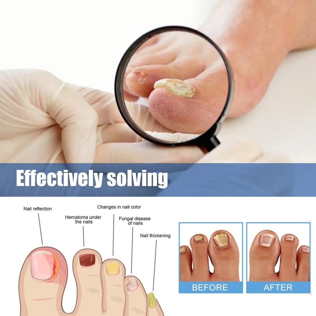 Nail nursing adhesive bandage repair stickers with 32 patches measuring 6.1x3.5 cm