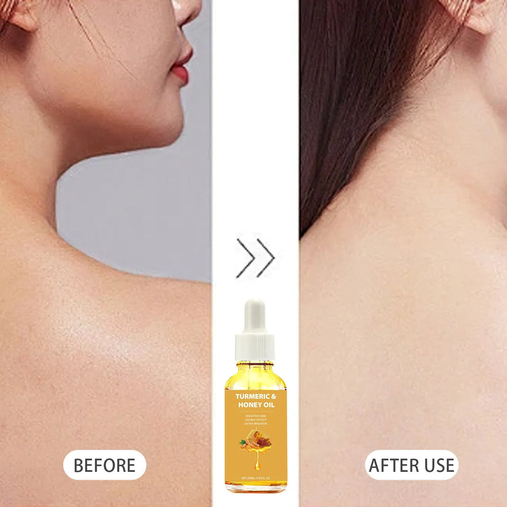 30ml bottle of turmeric honey essential oil with neutral packaging for facial beauty application