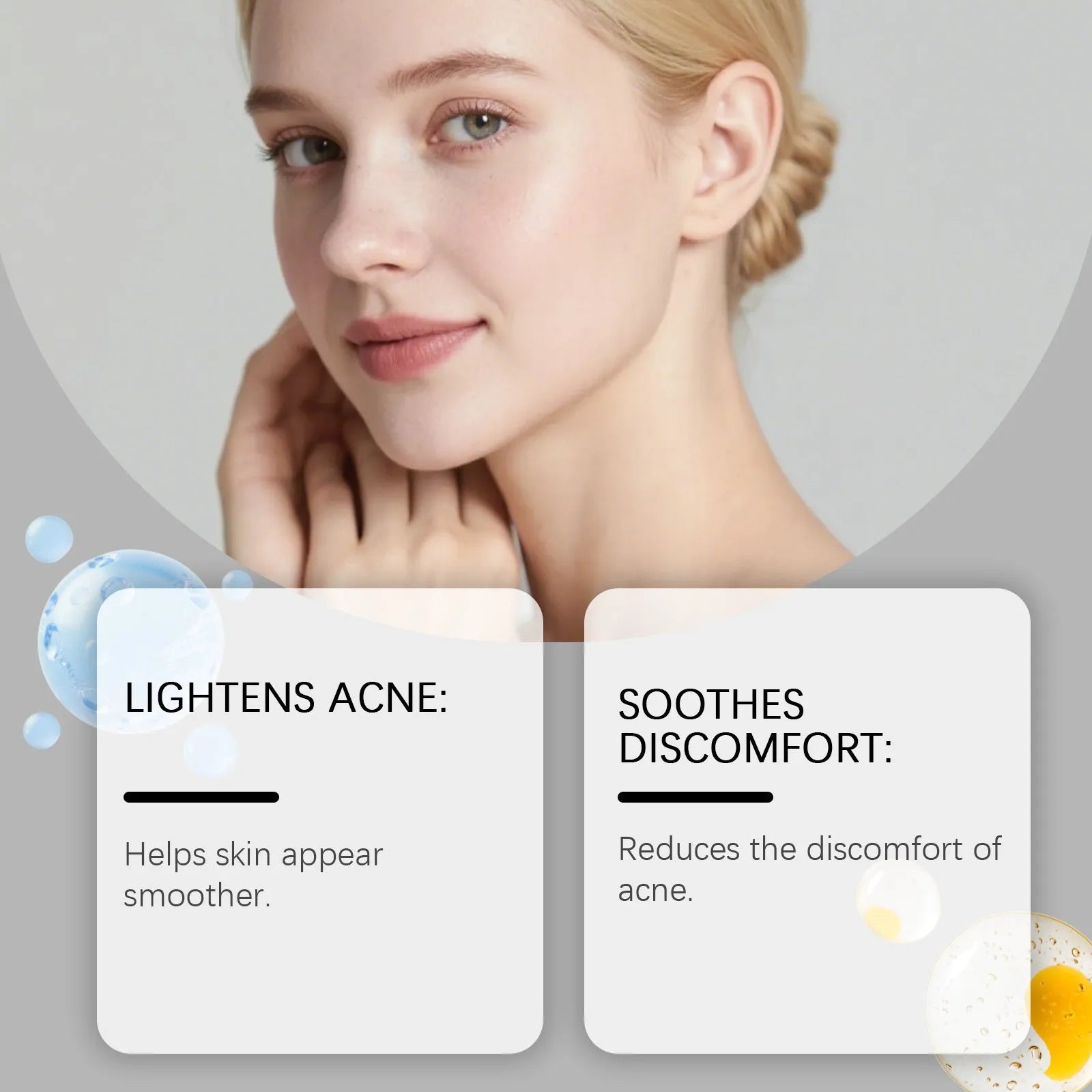 80-count pack of gentle daily cleaning facial acne patches with hydrocolloid material